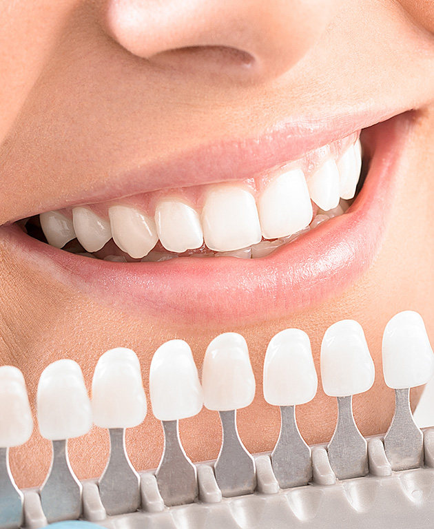tooth whitening comparison chart